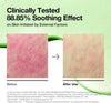 Anua - Azelaic 10 Hyaluron Redness Soothing Pad