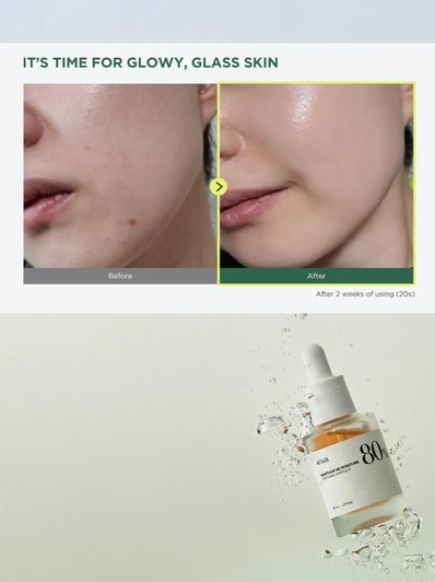 Anua - Heartleaf 80% Soothing Ampoule
