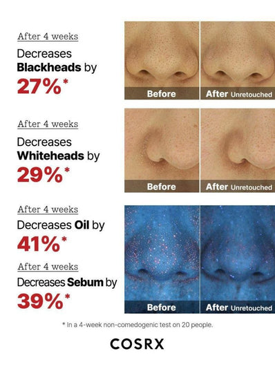 Cosrx - The AHA 2 BHA 2 Blemish Treatment Serum
