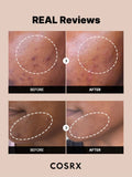 Cosrx - The Alpha Arbutin 2 Discoloration Care Serum