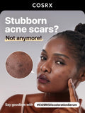 Cosrx - The Alpha Arbutin 2 Discoloration Care Serum