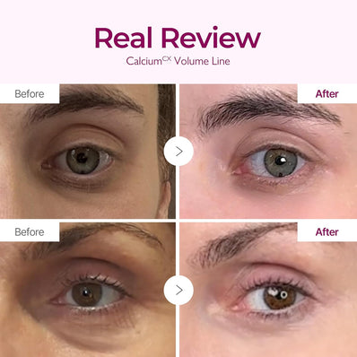 Dr.Melaxin - Cemenrete Calcium Intense Cream