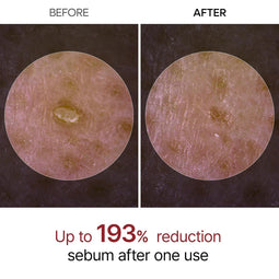 Dr. Melaxin Peel Shot Exfoliant White Rice Ampoule