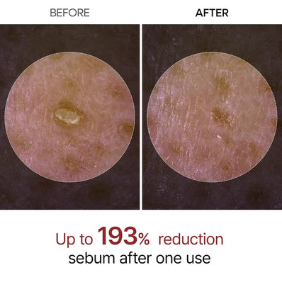 Dr. Melaxin Peel Shot Exfoliant White Rice Ampoule
