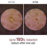 Dr. Melaxin Peel Shot Exfoliant White Rice Ampoule