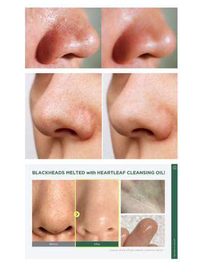 Anua - Heartleaf Pore Control Cleansing Oil