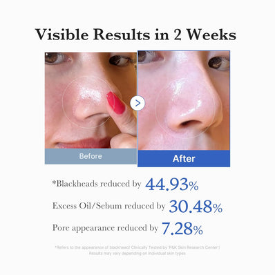 Medicube - Zero Pore Pad 2.0