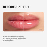 VT Cosmetics - Reedle Shot Lip Plumper Expert