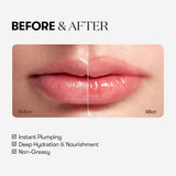 VT Cosmetics - Reedle Shot Lip Plumper Beginner