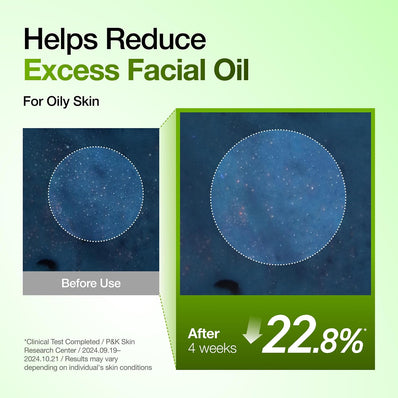 Anua - Azelaic Acid 10 Hyaluron Redness Soothing Serum