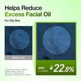 Anua - Azelaic Acid 10 Hyaluron Redness Soothing Serum