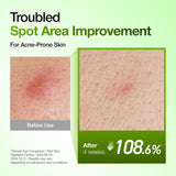 Anua - Azelaic Acid 10 Hyaluron Redness Soothing Serum