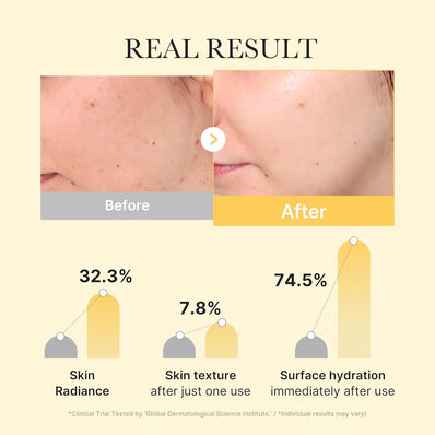Medicube - Kojic Acid Turmeric Brightening Gel Mask