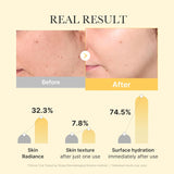 Medicube - Kojic Acid Turmeric Brightening Gel Mask