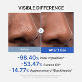 Medicube - Zero Pore Blackhead Mud Mask
